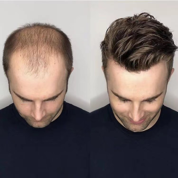 How to choose the best toupee for you?